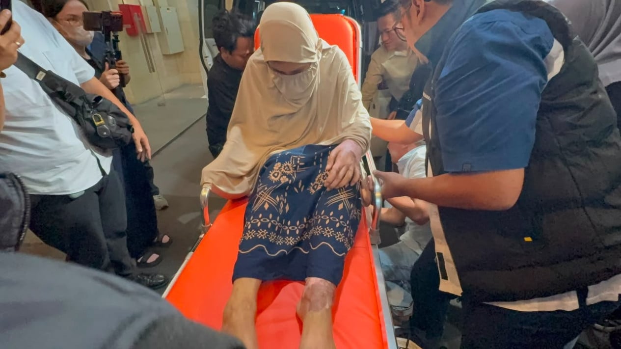 Oknum Polisi Diduga Siksa Istri: Korban Dicekoki Sabu hingga Alami Luka Bakar 47 Persen